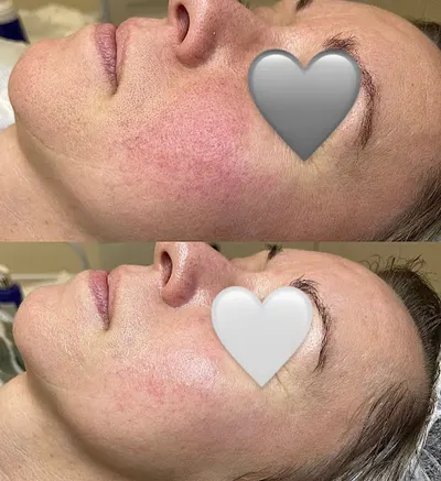 Skin Now- kosmetologia skór problematycznych Nikola Lanzarotti